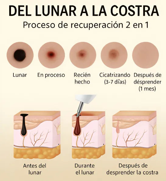 Quita Verrugas Pluma Plasma