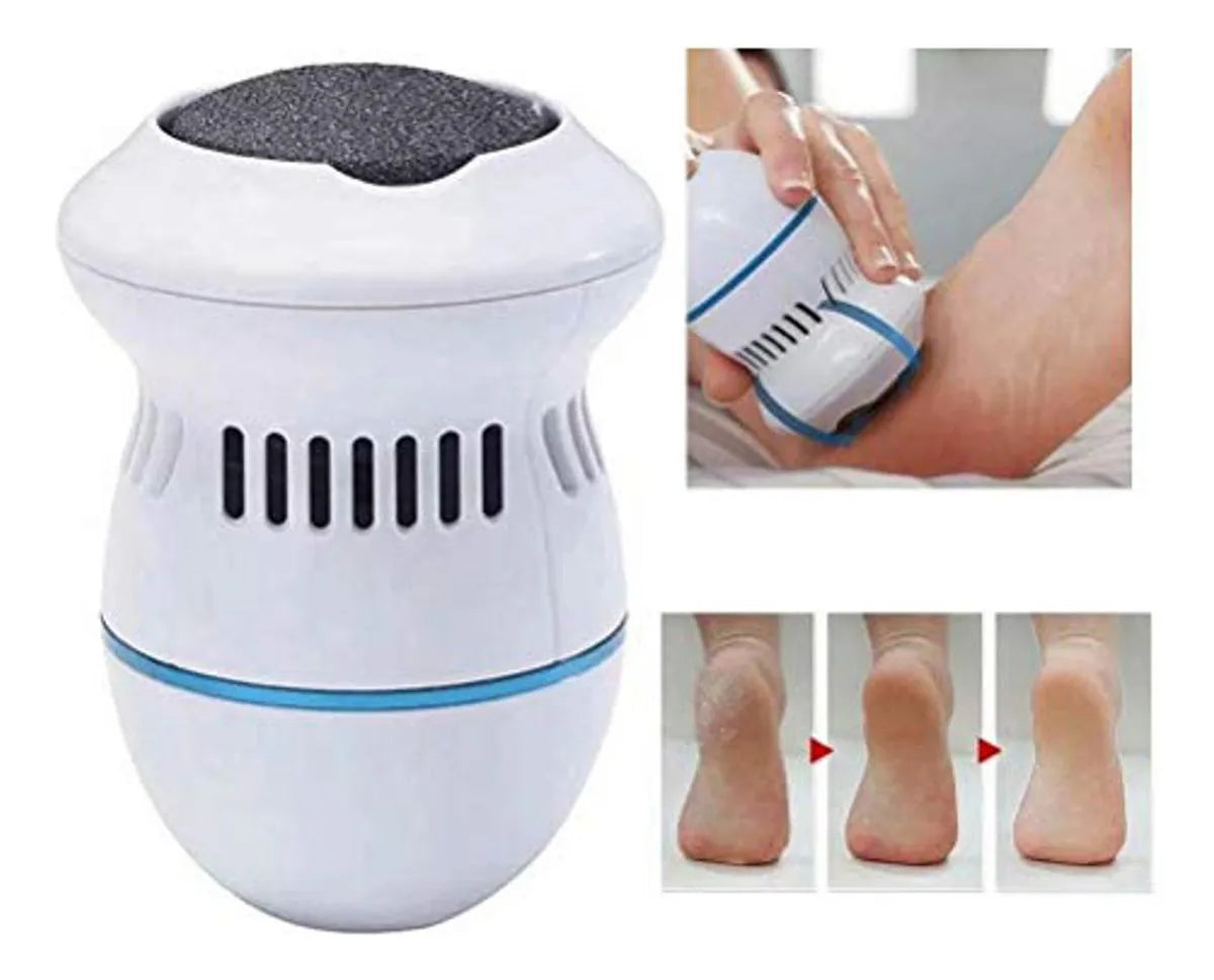 Removedor De Callos Exfoliador de Pies con Succión